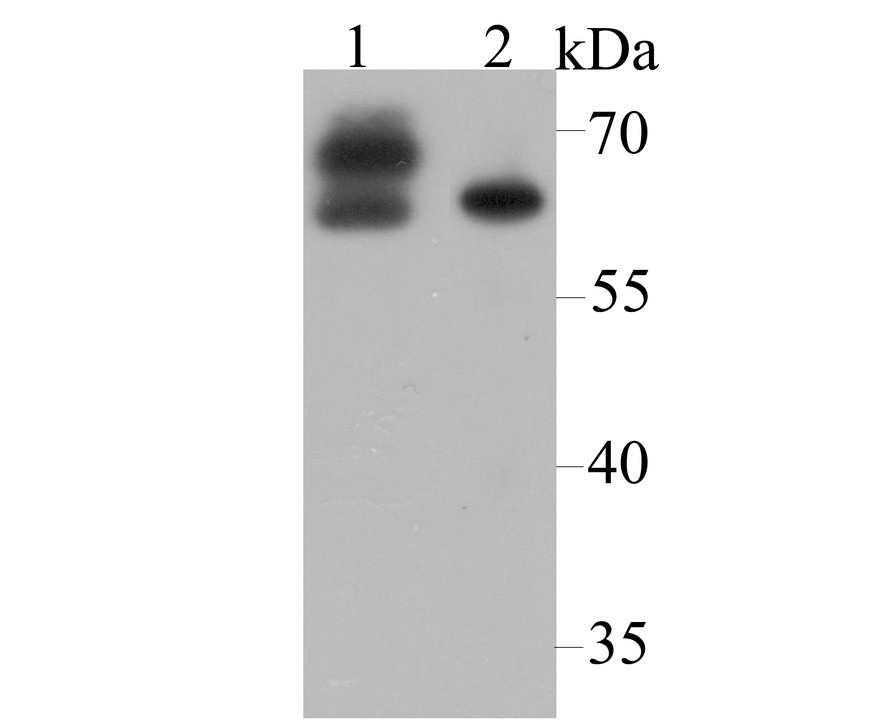 Western blot analysis of CRMP2 on different lysates using anti-CRMP2 antibody at 1/5,000 dilution.<br />
 Positive control:<br />
 Lane 1: Mouse brain tissue   Lane 2: SH-SY-5Y