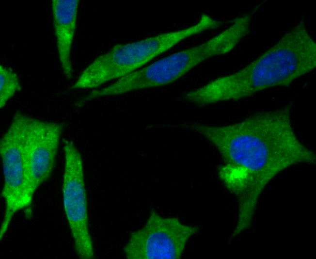 ICC staining CRMP2 in SH-SY-5Y cells (green). The nuclear counter stain is DAPI (blue). Cells were fixed in paraformaldehyde, permeabilised with 0.25% Triton X100/PBS.