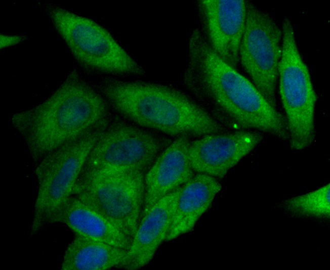 ICC staining CRMP2 in SiHa cells (green). The nuclear counter stain is DAPI (blue). Cells were fixed in paraformaldehyde, permeabilised with 0.25% Triton X100/PBS.