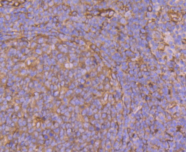 Immunohistochemical analysis of paraffin-embedded human tonsil tissue using anti-CRMP2 antibody. Counter stained with hematoxylin.
