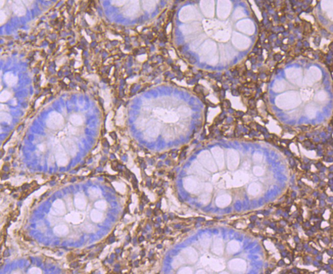 Immunohistochemical analysis of paraffin-embedded human colon tissue using anti-CRMP2 antibody. Counter stained with hematoxylin.