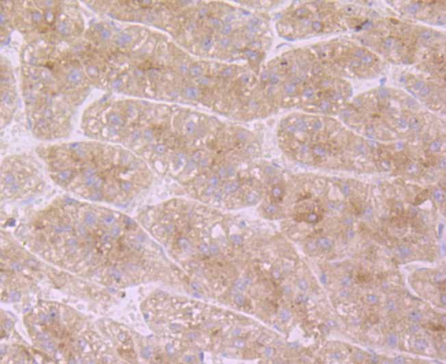 Immunohistochemical analysis of paraffin-embedded human liver tissue using anti-APOC3 antibody. Counter stained with hematoxylin.