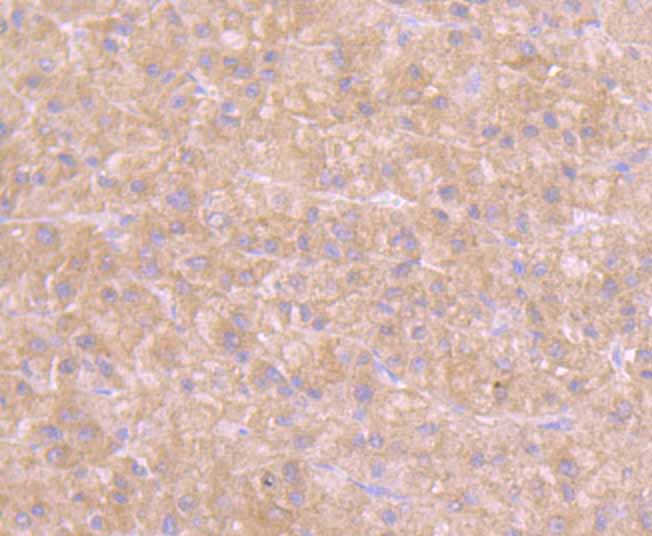 Immunohistochemical analysis of paraffin-embedded human liver tissue using anti-GOT1 antibody. Counter stained with hematoxylin.