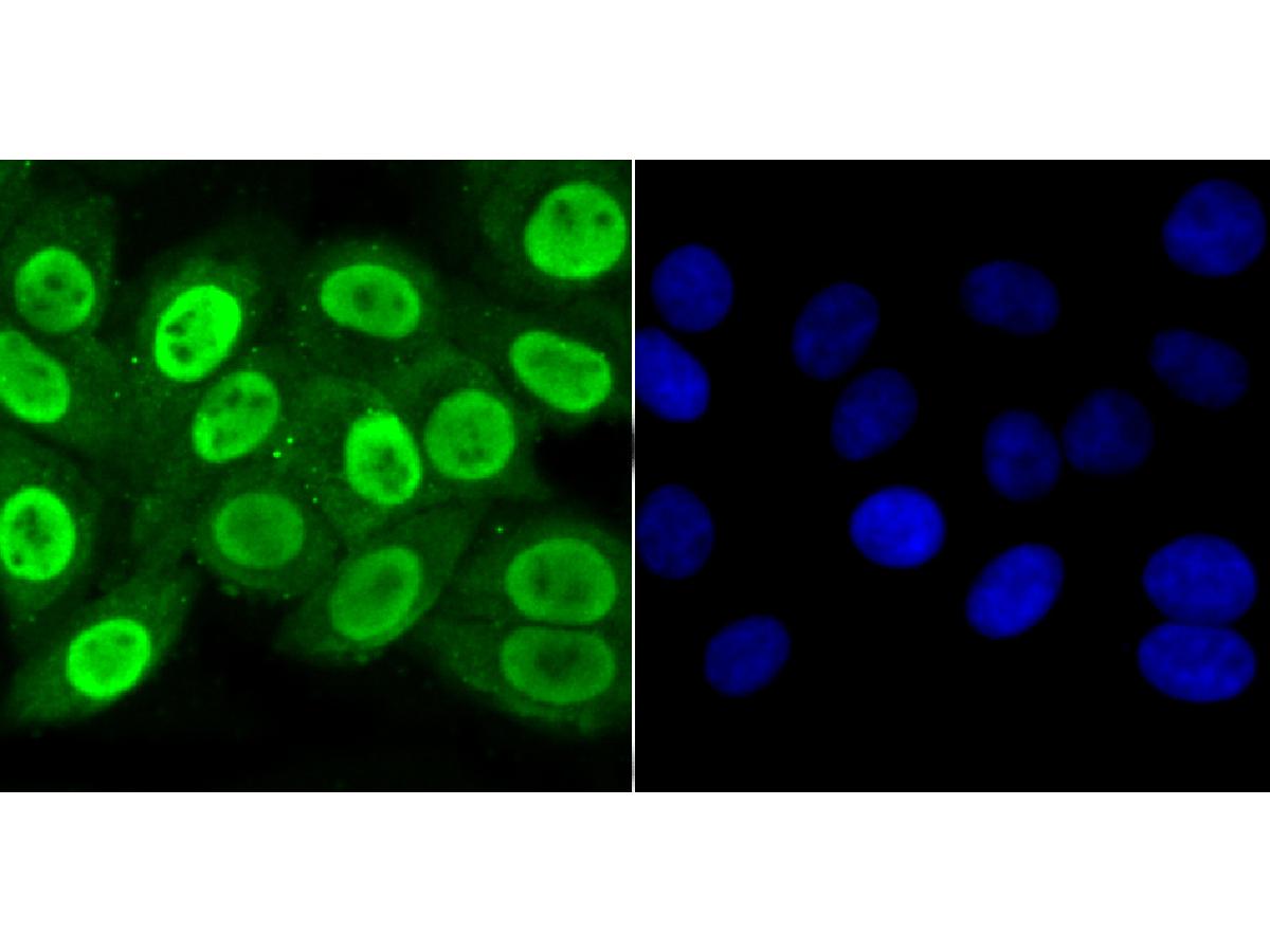 ICC staining APE1 in LOVO cells (green). The nuclear counter stain is DAPI (blue). Cells were fixed in paraformaldehyde, permeabilised with 0.25% Triton X100/PBS.