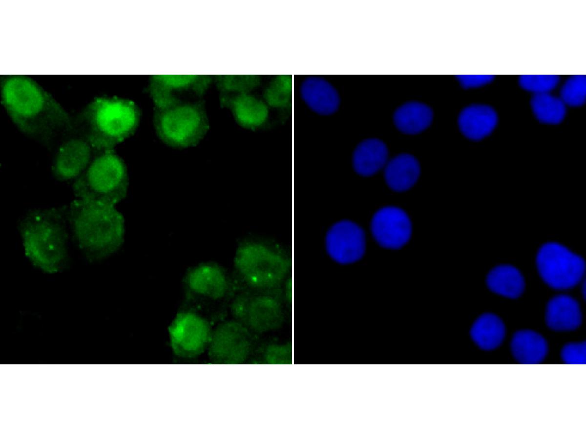 ICC staining APE1 in PC-3M cells (green). The nuclear counter stain is DAPI (blue). Cells were fixed in paraformaldehyde, permeabilised with 0.25% Triton X100/PBS.