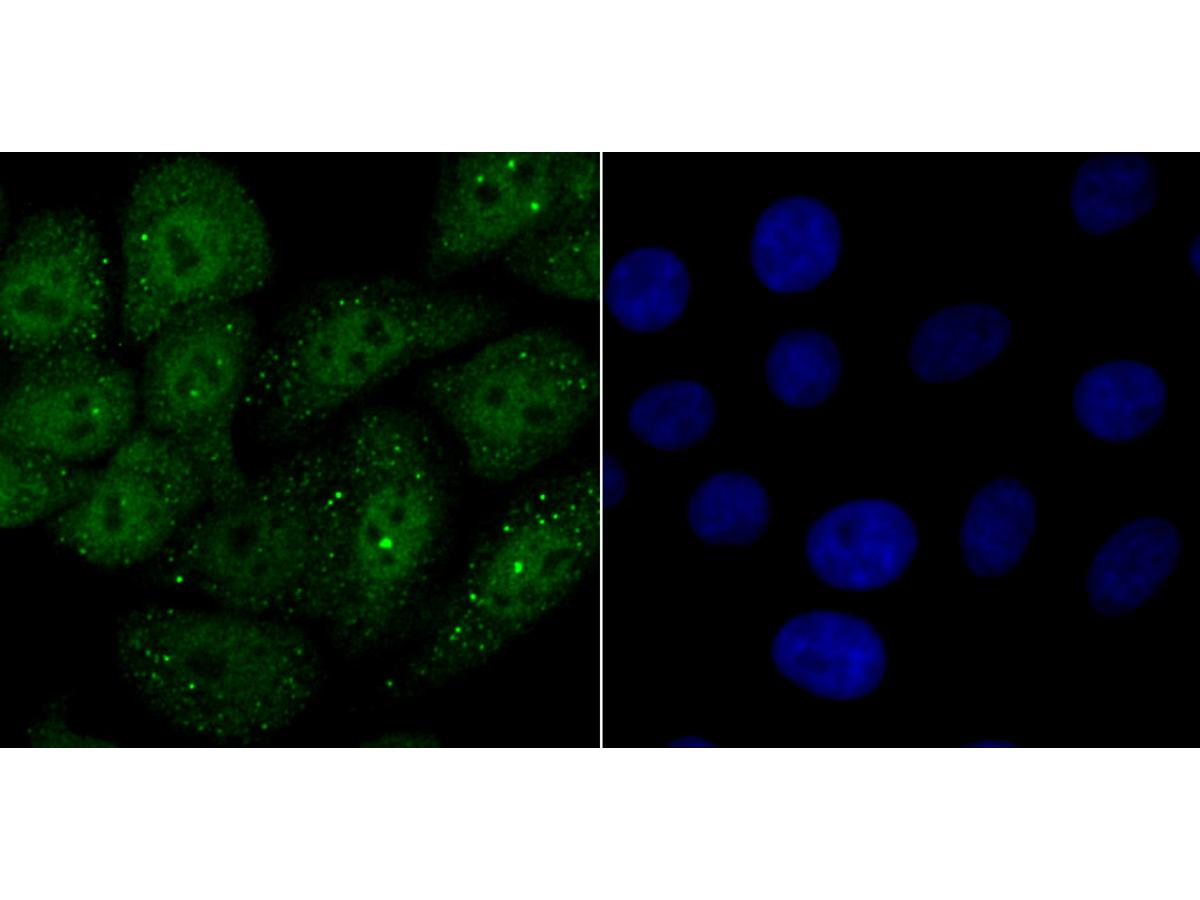 ICC staining NEDD8 in HepG2 cells (green). The nuclear counter stain is DAPI (blue). Cells were fixed in paraformaldehyde, permeabilised with 0.25% Triton X100/PBS.