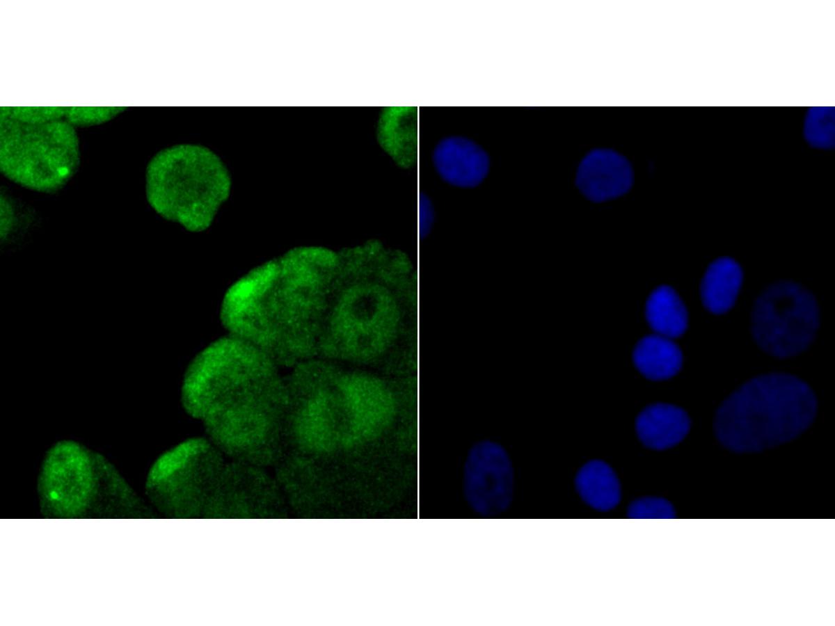ICC staining NEDD8 in MCF-7 cells (green). The nuclear counter stain is DAPI (blue). Cells were fixed in paraformaldehyde, permeabilised with 0.25% Triton X100/PBS.