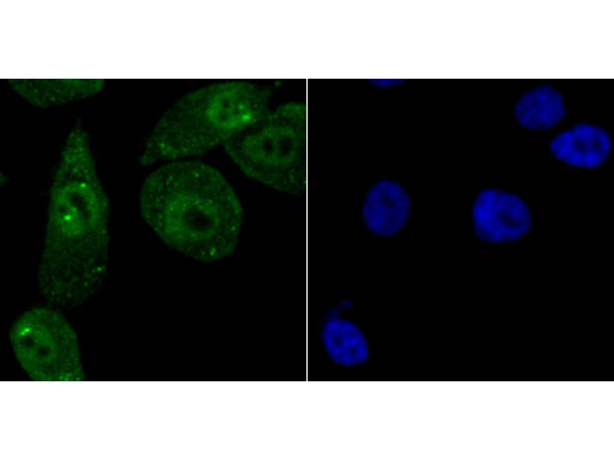 ICC staining NEDD8 in PC-3M cells (green). The nuclear counter stain is DAPI (blue). Cells were fixed in paraformaldehyde, permeabilised with 0.25% Triton X100/PBS.