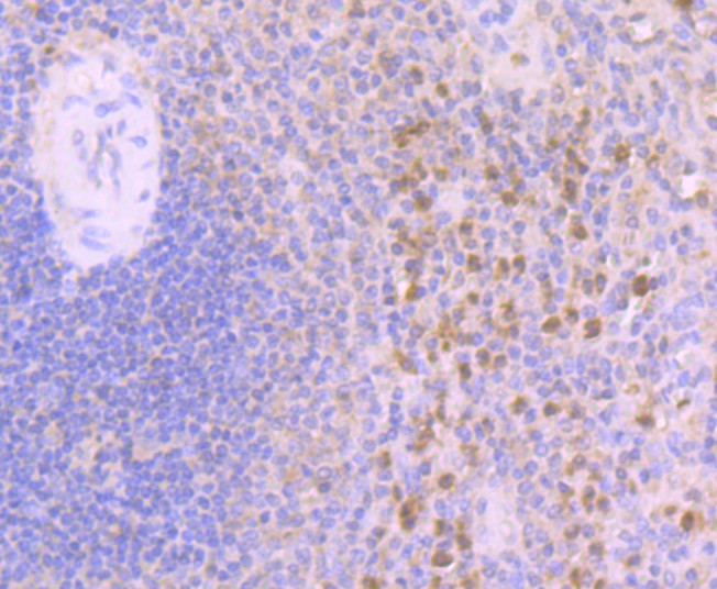 Immunohistochemical analysis of paraffin-embedded human spleen tissue using anti-Annexin A3 antibody. Counter stained with hematoxylin.