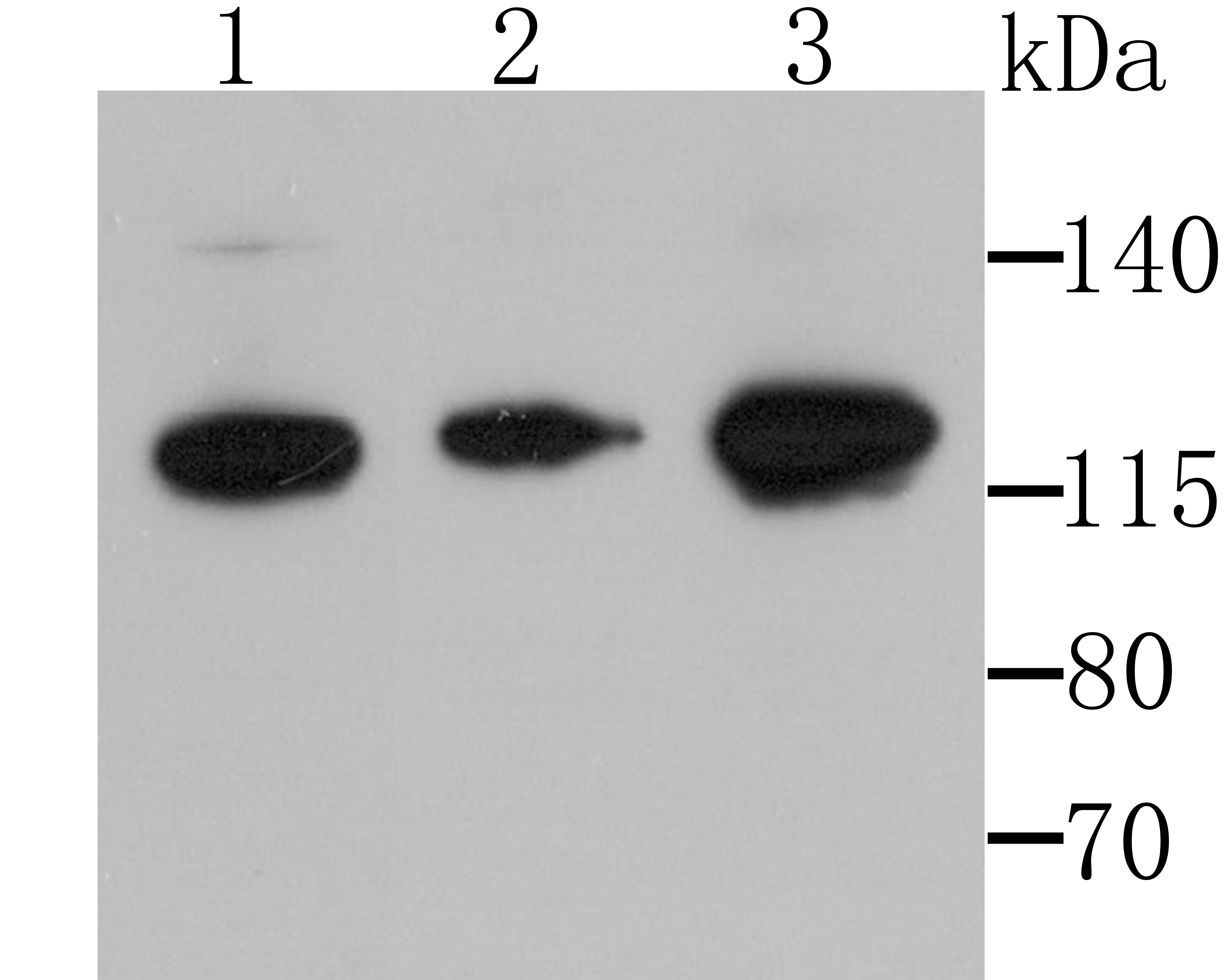 Western blot analysis of Hip1 on different tissue lysates using anti-Hip1 antibody at 1/500 dilution.<br />
 Positive control:<br />
 Lane 1: Mouse testis <br />
   Lane 2: Mouse spinal cord <br />
 Lane 3: SH-SY5Y