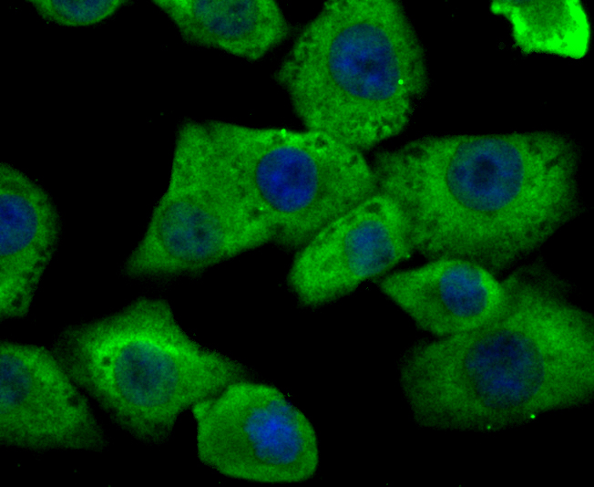 ICC staining Hip1 in A549 cells (green). The nuclear counter stain is DAPI (blue). Cells were fixed in paraformaldehyde, permeabilised with 0.25% Triton X100/PBS.