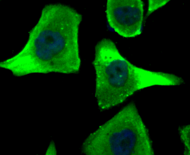 ICC staining Hip1 in PC-3M cells (green). The nuclear counter stain is DAPI (blue). Cells were fixed in paraformaldehyde, permeabilised with 0.25% Triton X100/PBS.
