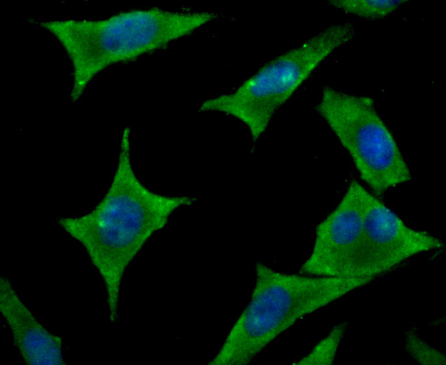 ICC staining Hip1 in SH-SY-5Y cells (green). The nuclear counter stain is DAPI (blue). Cells were fixed in paraformaldehyde, permeabilised with 0.25% Triton X100/PBS.