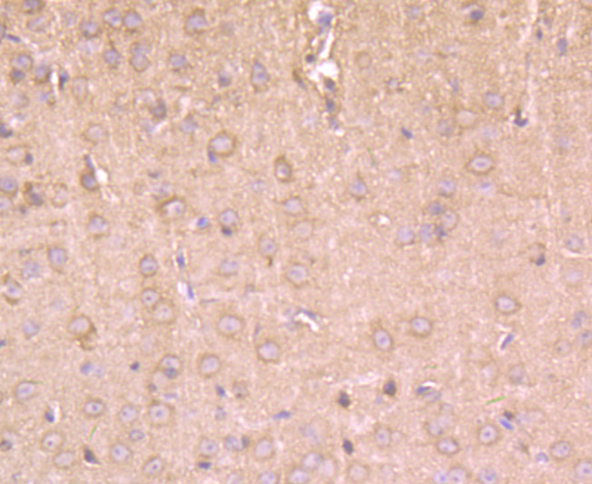 Immunohistochemical analysis of paraffin-embedded mouse brain tissue using anti-Hip1 antibody. Counter stained with hematoxylin.