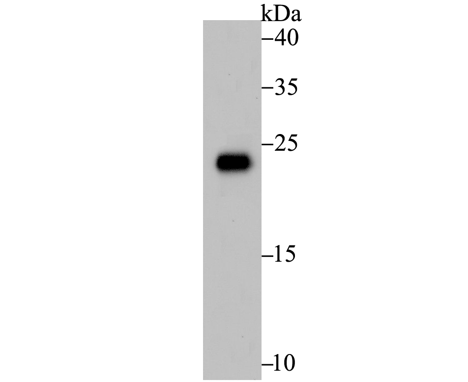 Western blot analysis of RAB7 on different lysates with Rabbit anti-RAB7 antibody (ER1802-53) at 1/1,000 dilution.<br />
<br />
Lane 1: MCF-7 cell lysate (20 µg/Lane)<br />
Lane 2: Rat brain tissue lysate (20 µg/Lane)<br />
Lane 2: Human brain tissue lysate (20 µg/Lane)<br />
<br />
Predicted band size: 23 kDa<br />
Observed band size: 23 kDa<br />
<br />
Exposure time: 2 minutes;<br />
<br />
15% SDS-PAGE gel.<br />
<br />
Proteins were transferred to a PVDF membrane and blocked with 5% NFDM/TBST for 1 hour at room temperature. The primary antibody (ER1802-53) at 1/1,000 dilution was used in 5% NFDM/TBST at room temperature for 2 hours. Goat Anti-Rabbit IgG - HRP Secondary Antibody (HA1001) at 1:300,000 dilution was used for 1 hour at room temperature.