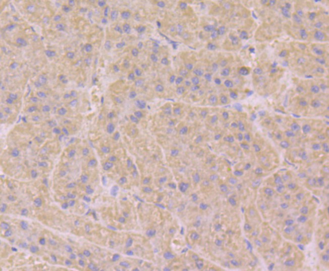 Immunohistochemical analysis of paraffin-embedded human liver tissue using anti-RAB7 antibody. Counter stained with hematoxylin.