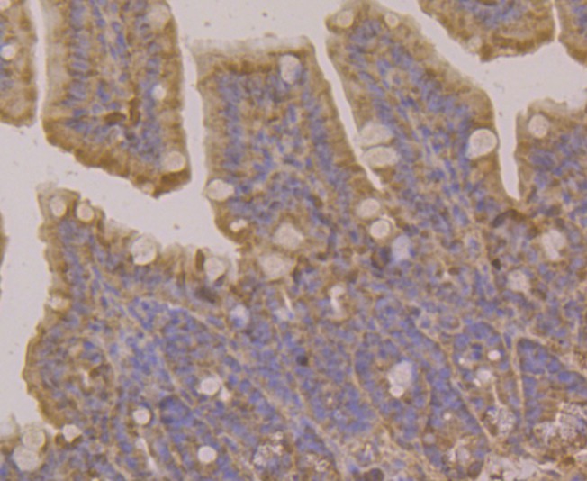 Immunohistochemical analysis of paraffin-embedded mouse colon tissue using anti-RAB7 antibody. Counter stained with hematoxylin.