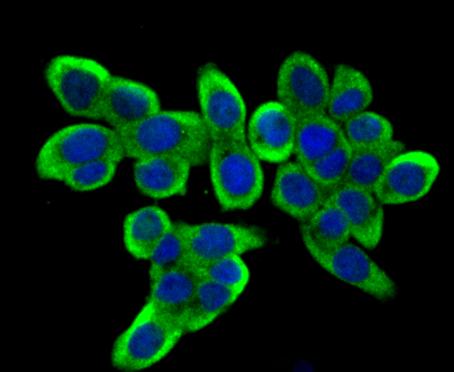 ICC staining DIAPH3 in LOVO cells (green). The nuclear counter stain is DAPI (blue). Cells were fixed in paraformaldehyde, permeabilised with 0.25% Triton X100/PBS.