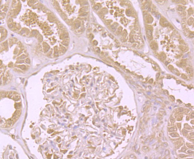 Immunohistochemical analysis of paraffin-embedded human kidney tissue using anti-DIAPH3 antibody. Counter stained with hematoxylin.