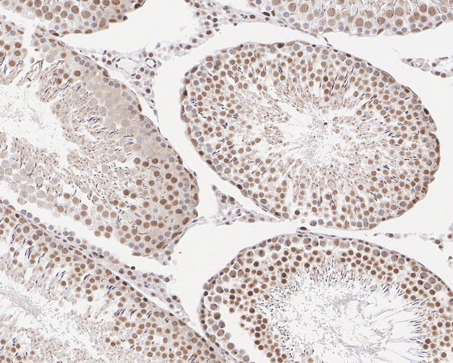 Immunohistochemical analysis of paraffin-embedded rat brain tissue using anti-Dnmt3b antibody. Counter stained with hematoxylin.