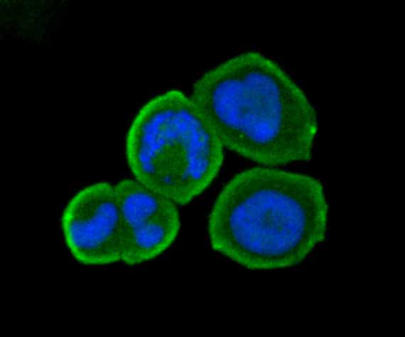 ICC staining B7-H4(VTCN1) in MCF-7 cells (green). The nuclear counter stain is DAPI (blue). Cells were fixed in paraformaldehyde, permeabilised with 0.25% Triton X100/PBS.