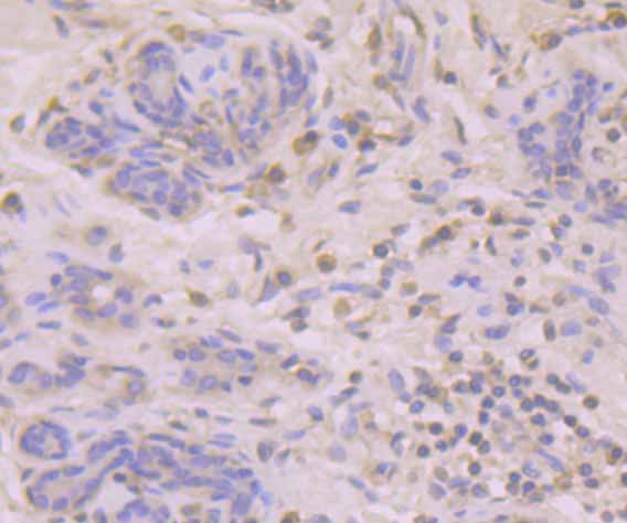 Immunohistochemical analysis of paraffin-embedded human breast tissue using anti-B7-H4(VTCN1) antibody. Counter stained with hematoxylin.
