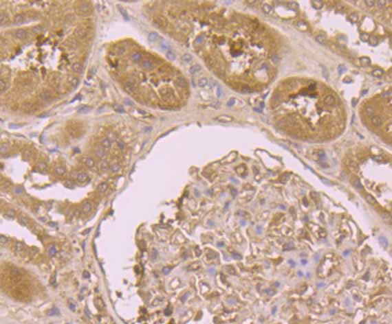 Immunohistochemical analysis of paraffin-embedded human kidney tissue using anti-B7-H4(VTCN1) antibody. Counter stained with hematoxylin.