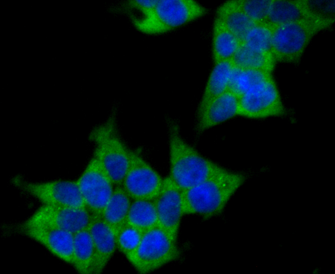 ICC staining Raptor in 293T cells (green). The nuclear counter stain is DAPI (blue). Cells were fixed in paraformaldehyde, permeabilised with 0.25% Triton X100/PBS.