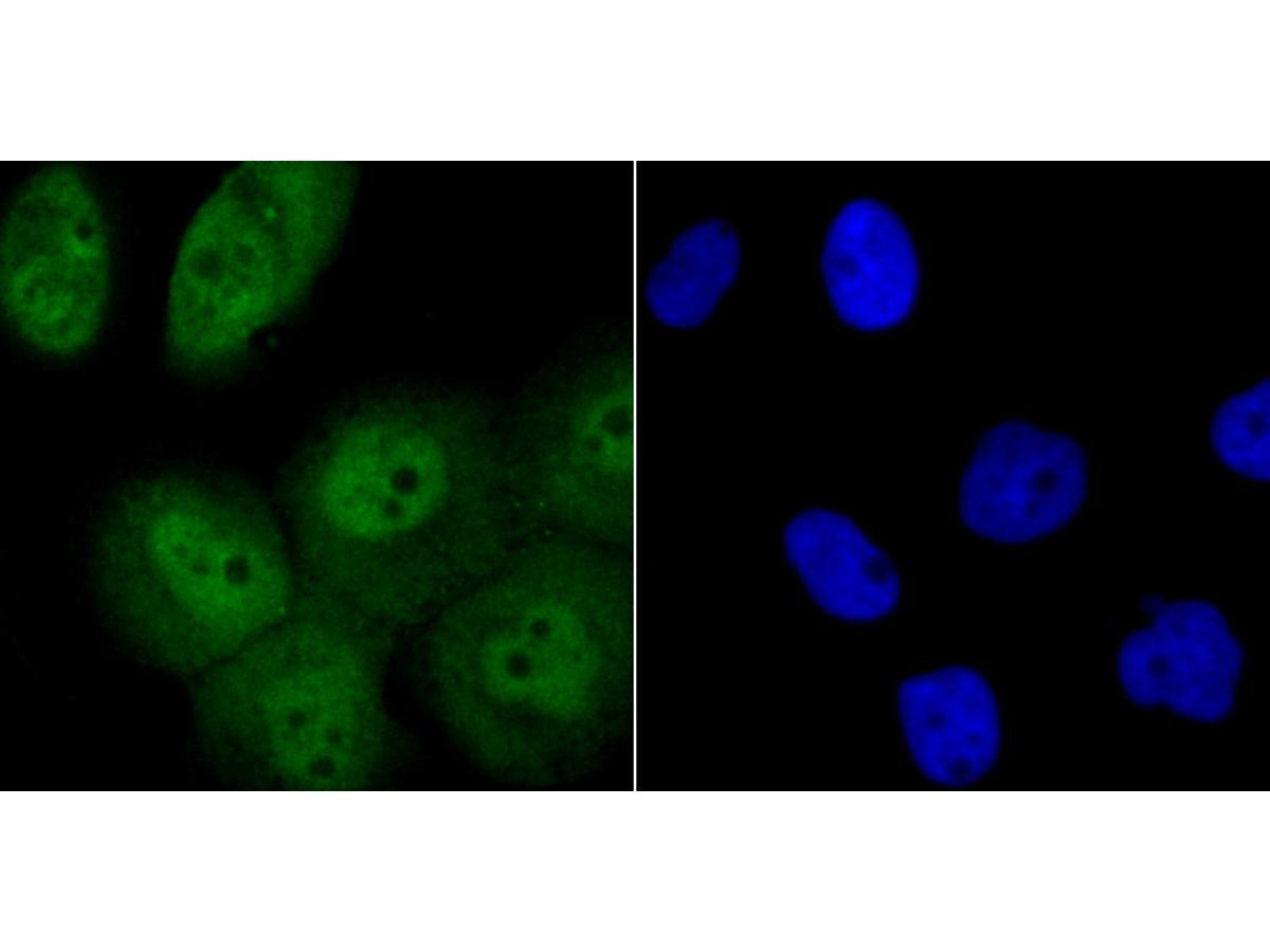 ICC staining Tle6 in A431 cells (green). The nuclear counter stain is DAPI (blue). Cells were fixed in paraformaldehyde, permeabilised with 0.25% Triton X100/PBS.