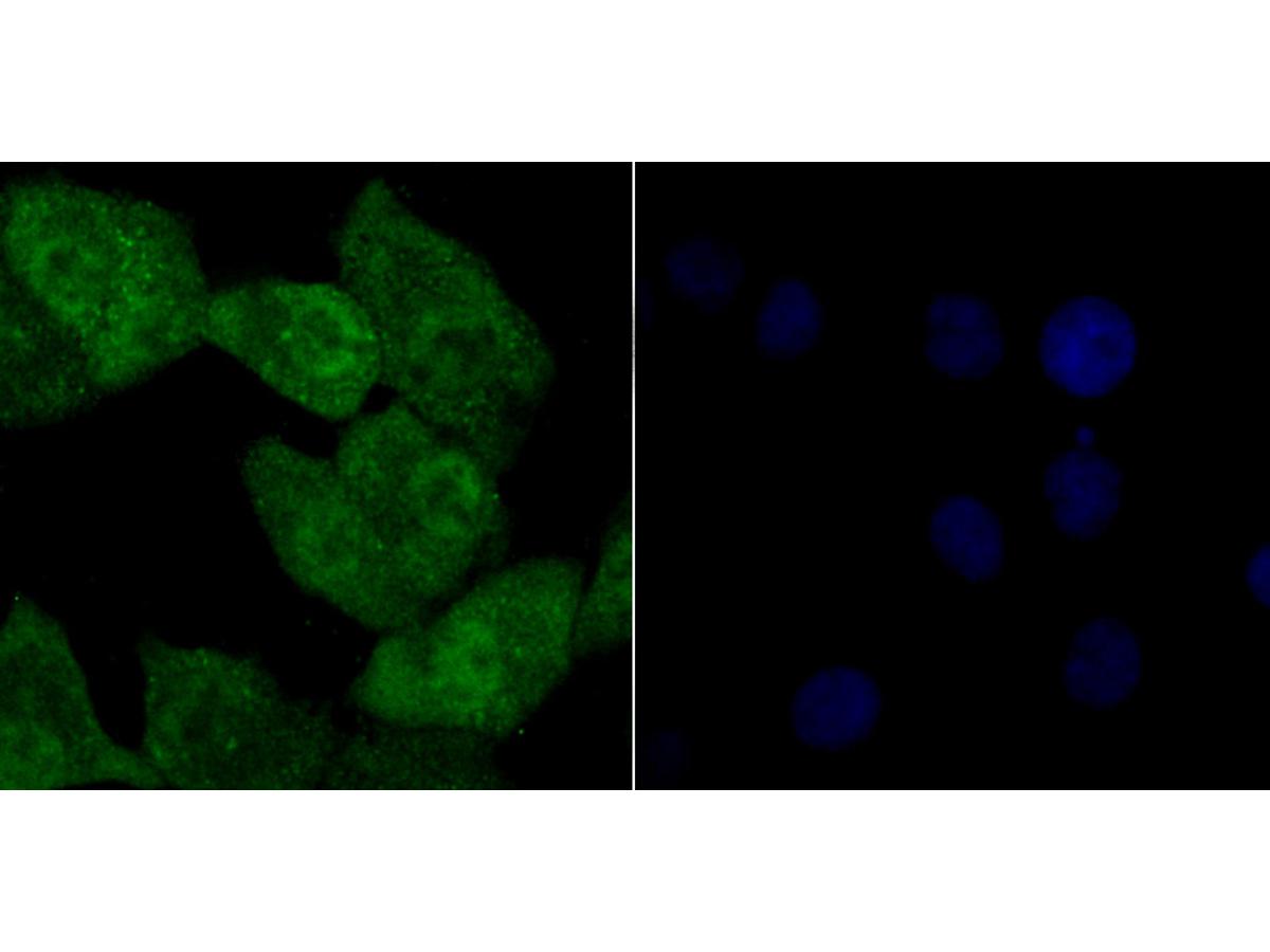 ICC staining Tle6 in A549 cells (green). The nuclear counter stain is DAPI (blue). Cells were fixed in paraformaldehyde, permeabilised with 0.25% Triton X100/PBS.