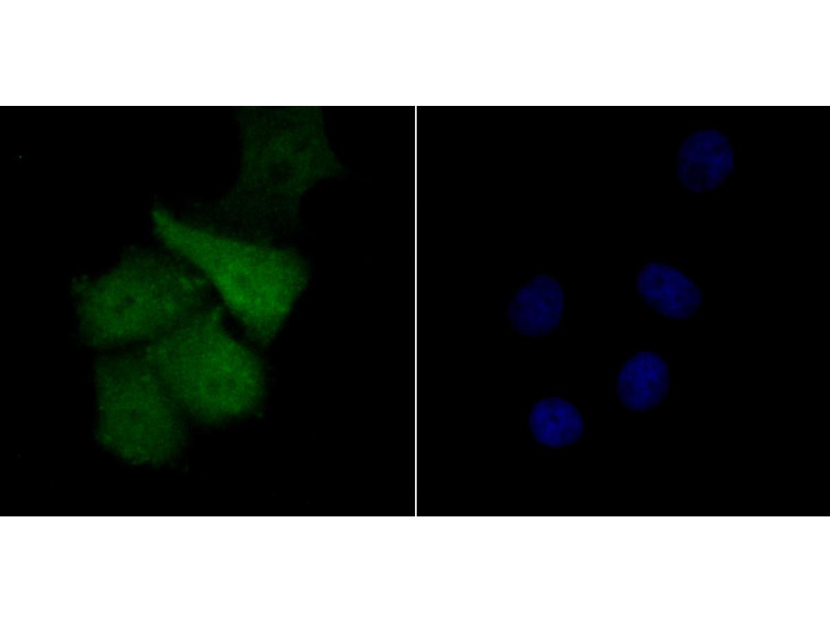 ICC staining Tle6 in SK-Br-3 cells (green). The nuclear counter stain is DAPI (blue). Cells were fixed in paraformaldehyde, permeabilised with 0.25% Triton X100/PBS.