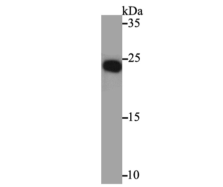Western blot analysis of NGF on recombinant protein lysate using anti-NGF antibody at 1/500 dilution.