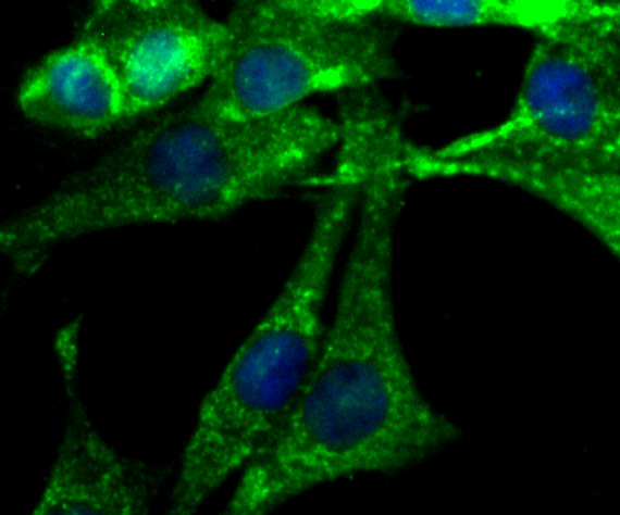 ICC staining NGF in SHG-44 cells (green). The nuclear counter stain is DAPI (blue). Cells were fixed in paraformaldehyde, permeabilised with 0.25% Triton X100/PBS.