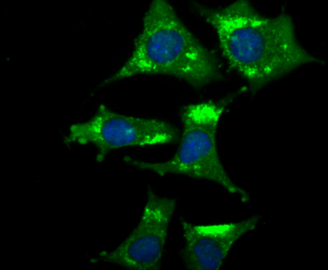 ICC staining NGF in SH-SY-5Y cells (green). The nuclear counter stain is DAPI (blue). Cells were fixed in paraformaldehyde, permeabilised with 0.25% Triton X100/PBS.
