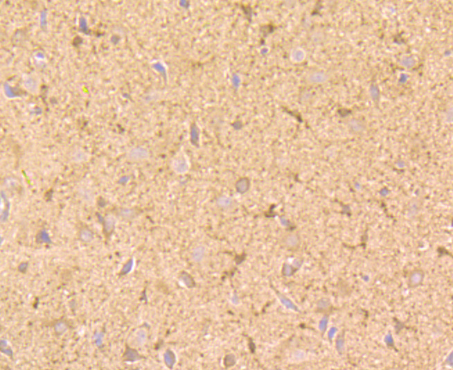 Immunohistochemical analysis of paraffin-embedded rat brain tissue using anti-NGF antibody. Counter stained with hematoxylin.