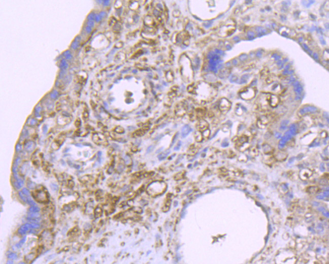 Immunohistochemical analysis of paraffin-embedded human placenta tissue using anti-SDF1 antibody. Counter stained with hematoxylin.