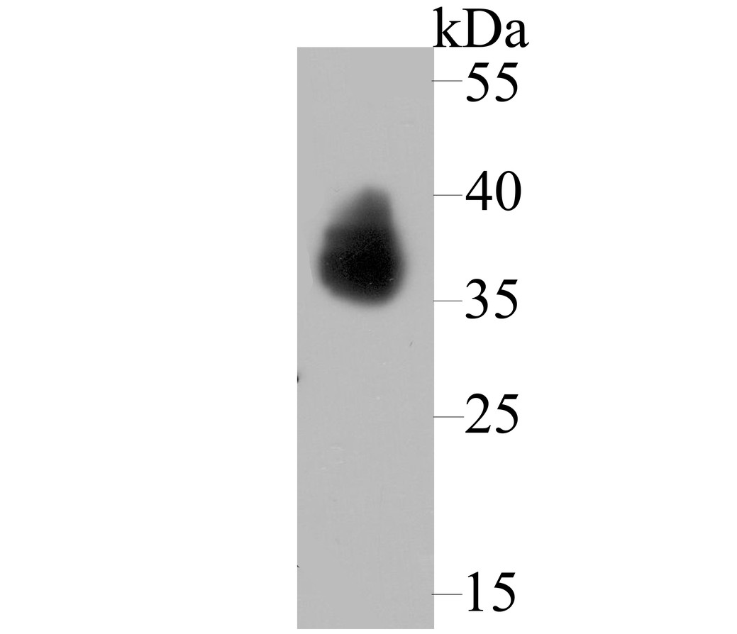 Western blot analysis of TROP2 on A431 cell lysates. Proteins were transferred to a PVDF membrane and blocked with 5% BSA in PBS for 1 hour at room temperature. The primary antibody (ER1802-60, 1/500) was used in 5% BSA at room temperature for 2 hours. Goat Anti-Rabbit IgG - HRP Secondary Antibody (HA1001) at 1:5,000 dilution was used for 1 hour at room temperature.
