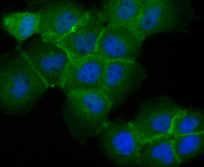 ICC staining of TROP2 in A431 cells (green). Formalin fixed cells were permeabilized with 0.1% Triton X-100 in TBS for 10 minutes at room temperature and blocked with 1% Blocker BSA for 15 minutes at room temperature. Cells were probed with the primary antibody (ER1802-60, 1/50) for 1 hour at room temperature, washed with PBS. Alexa Fluor®488 Goat anti-Rabbit IgG was used as the secondary antibody at 1/1,000 dilution. The nuclear counter stain is DAPI (blue).