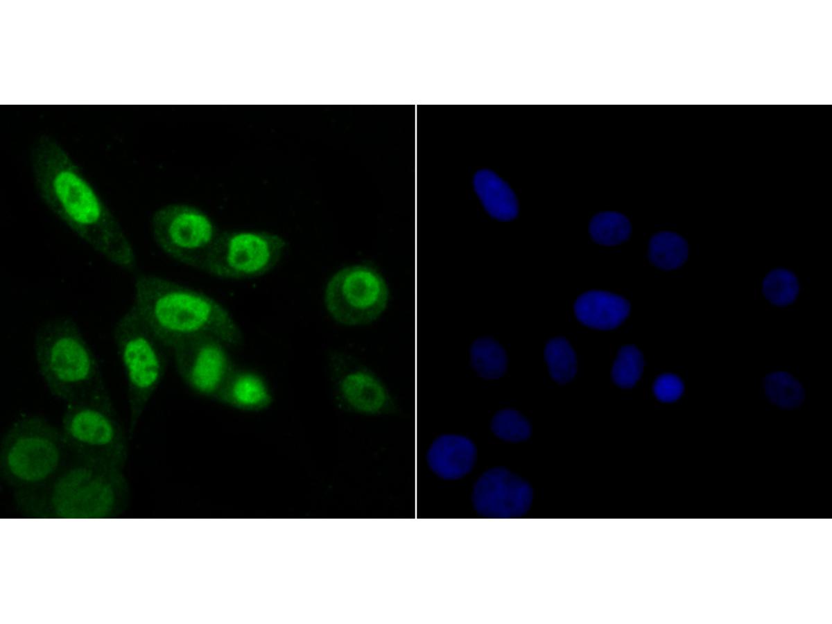 ICC staining Rae1 in LOVO cells (green). The nuclear counter stain is DAPI (blue). Cells were fixed in paraformaldehyde, permeabilised with 0.25% Triton X100/PBS.