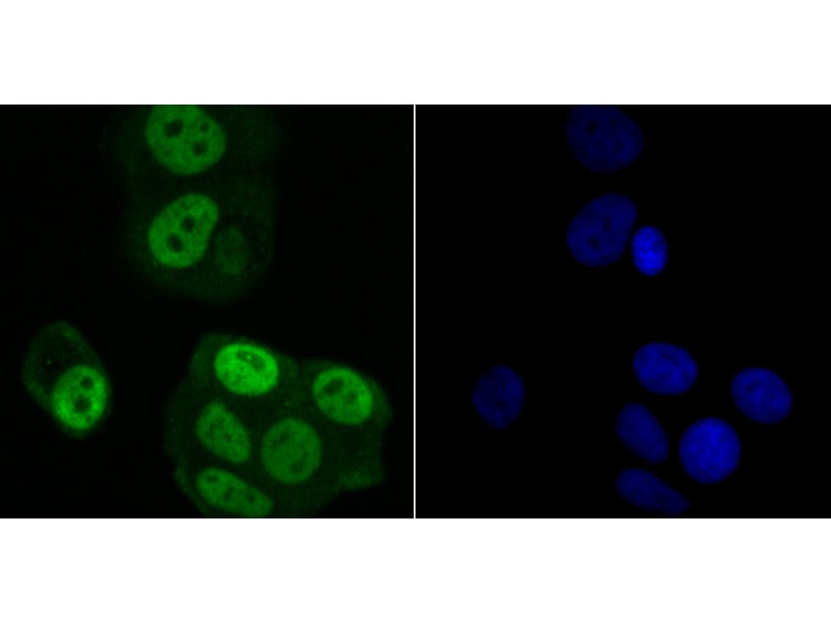 ICC staining Rae1 in MCF-7 cells (green). The nuclear counter stain is DAPI (blue). Cells were fixed in paraformaldehyde, permeabilised with 0.25% Triton X100/PBS.