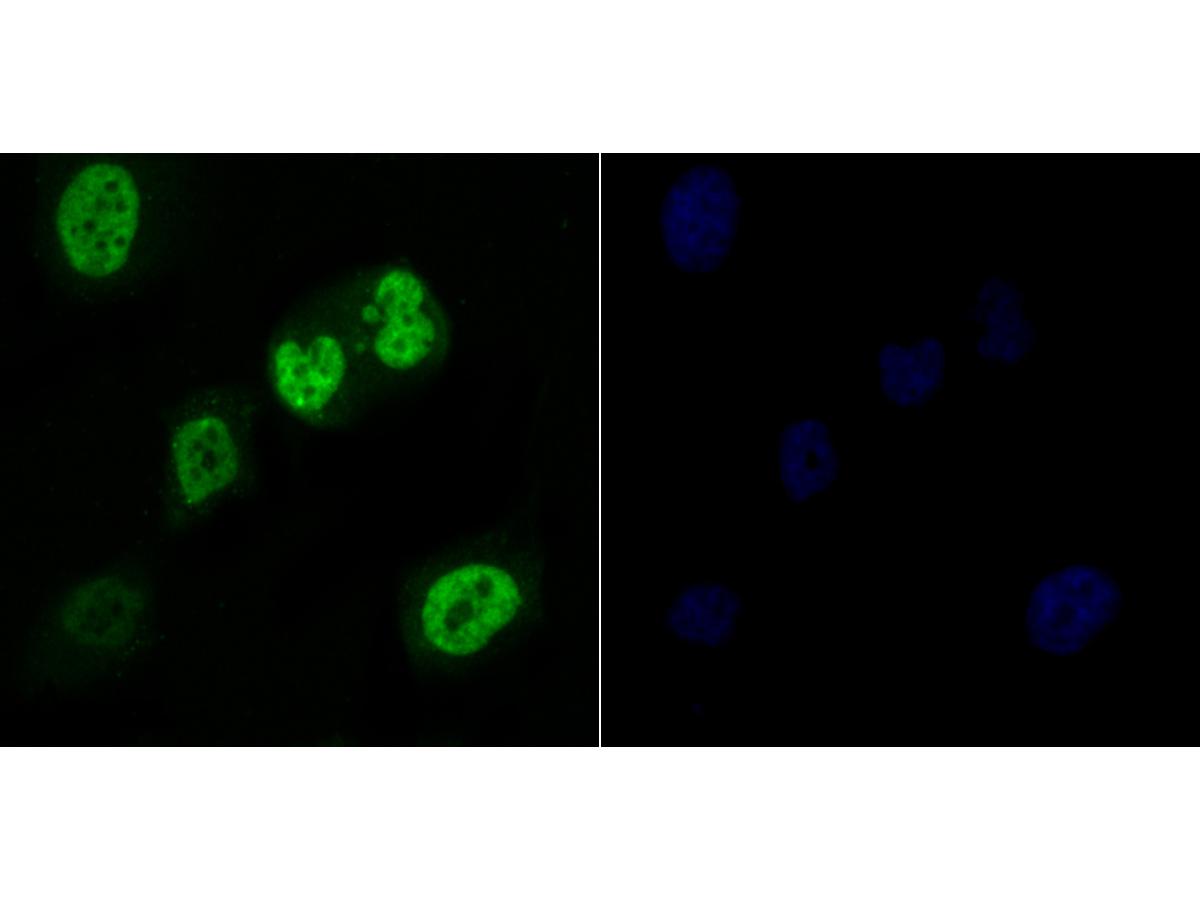 ICC staining Rae1 in PC-3M cells (green). The nuclear counter stain is DAPI (blue). Cells were fixed in paraformaldehyde, permeabilised with 0.25% Triton X100/PBS.