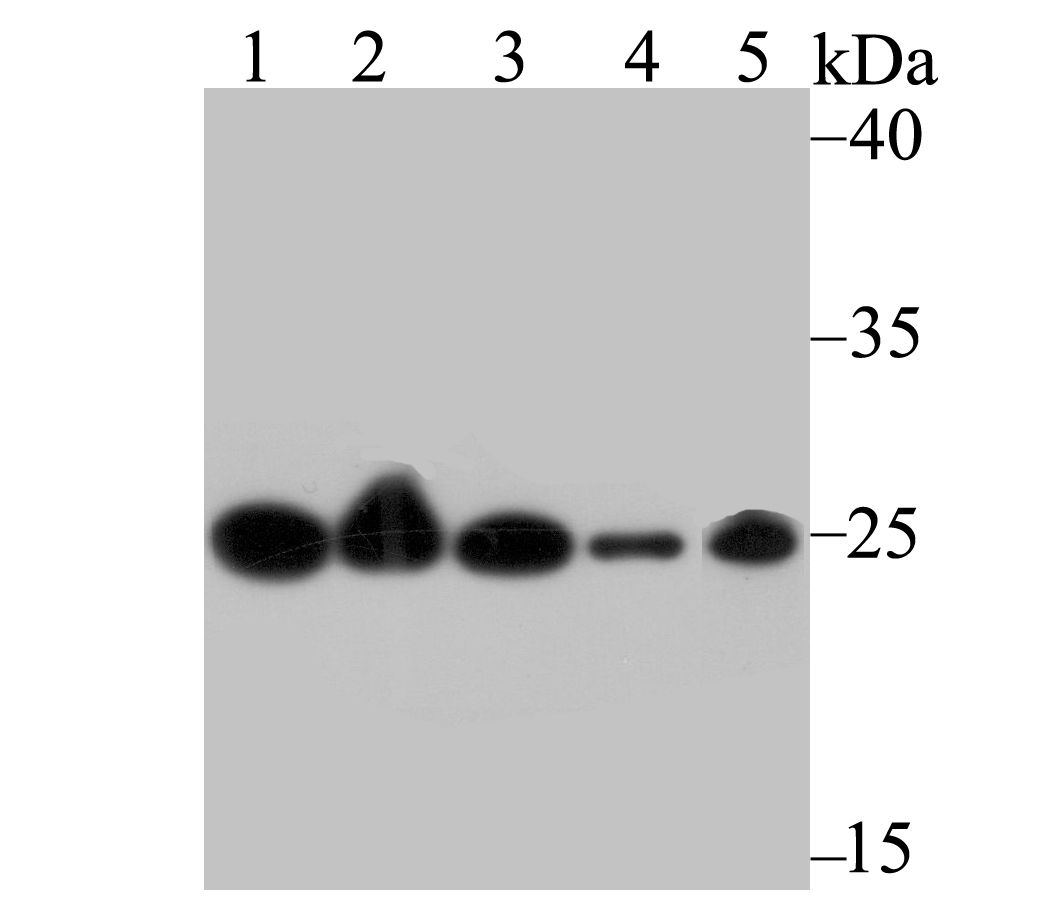 Western blot analysis of GST3 on different cell lysate using anti-GST3 antibody at 1/1,000 dilution.<br />
Positive control:<br />
Lane 1: SiHa cell lysate<br />
Lane 2: Hela cell lysate<br />
Lane 3: A549 cell lysate<br />
Lane 4: Mouse kidney tissue lysate<br />
Lane 5: Rat liver tissue lysate