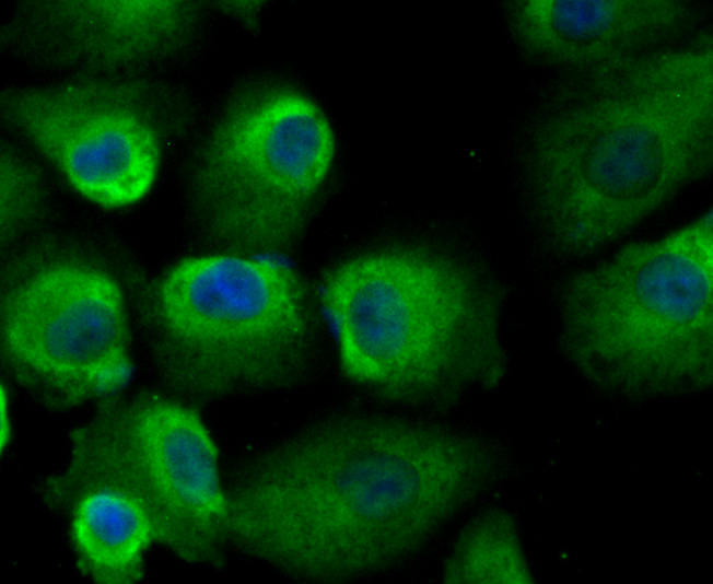 ICC staining GST3 in A549 cells (green). The nuclear counter stain is DAPI (blue). Cells were fixed in paraformaldehyde, permeabilised with 0.25% Triton X100/PBS.