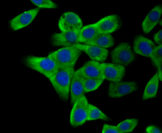 ICC staining GST3 in LOVO cells (green). The nuclear counter stain is DAPI (blue). Cells were fixed in paraformaldehyde, permeabilised with 0.25% Triton X100/PBS.