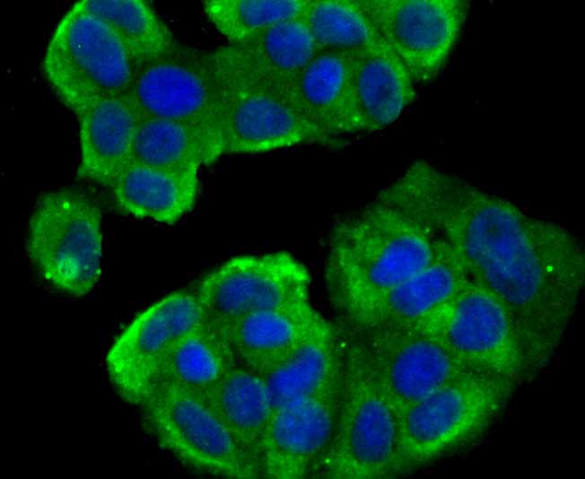 ICC staining TWEAKR in MCF-7 cells (green). The nuclear counter stain is DAPI (blue). Cells were fixed in paraformaldehyde, permeabilised with 0.25% Triton X100/PBS.