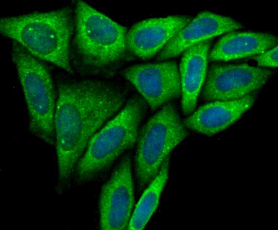 ICC staining TWEAKR in SiHa cells (green). The nuclear counter stain is DAPI (blue). Cells were fixed in paraformaldehyde, permeabilised with 0.25% Triton X100/PBS.