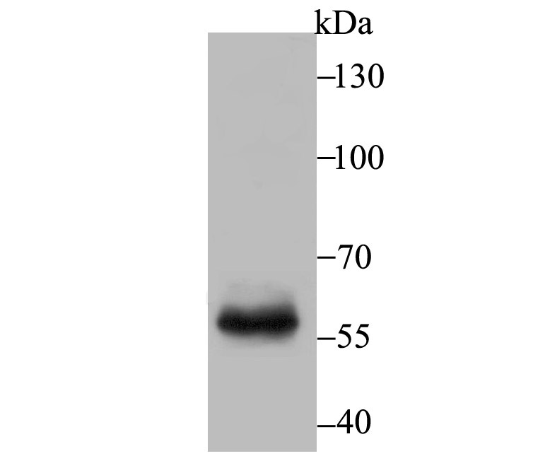 Western blot analysis of T-bet on mouse marrow tissue lysate using anti-T-bet antibody at 1/500 dilution.