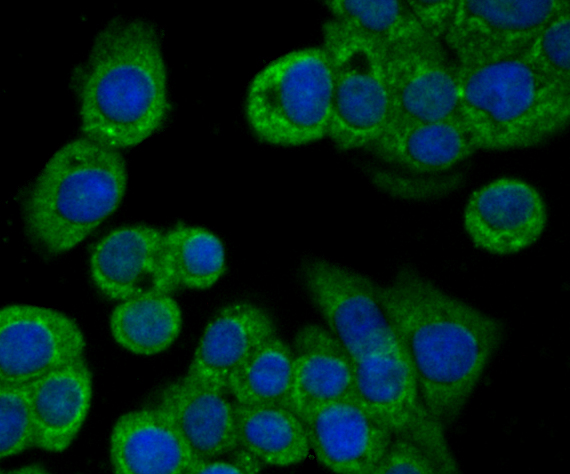 ICC staining BNIP1 in LOVO cells (green). The nuclear counter stain is DAPI (blue). Cells were fixed in paraformaldehyde, permeabilised with 0.25% Triton X100/PBS.