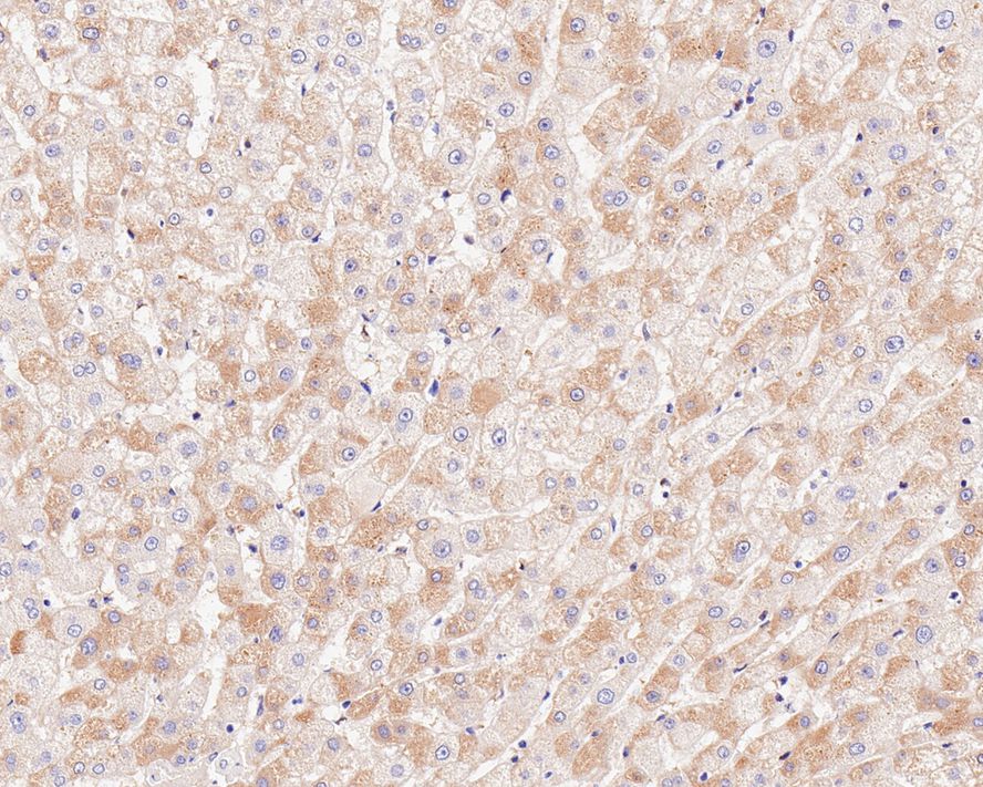 Immunohistochemical analysis of paraffin-embedded human liver tissue using anti-BNIP1 antibody. Counter stained with hematoxylin.