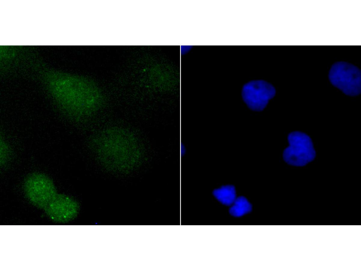 ICC staining PARP1 in A431 cells (green). The nuclear counter stain is DAPI (blue). Cells were fixed in paraformaldehyde, permeabilised with 0.25% Triton X100/PBS.